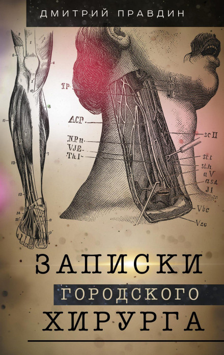 Записки городского хирурга